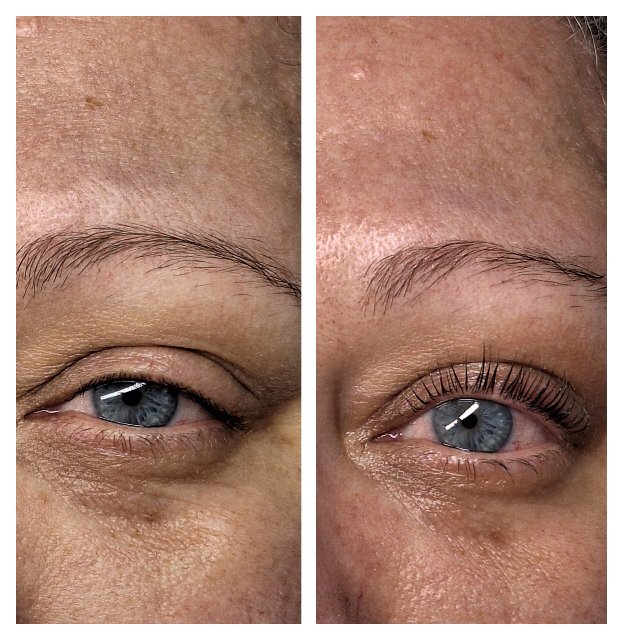 Before and after photo of a professional skin rejuvenation treatment at Makeover by Rafaella.